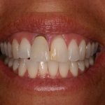Up close photo of teeth