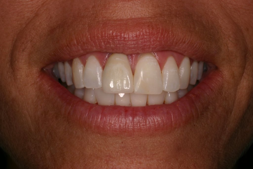 Up close photo of teeth