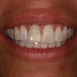 Up close photo of teeth