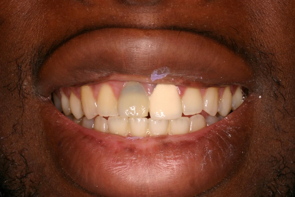 Up close photo of teeth