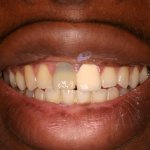 Up close photo of teeth