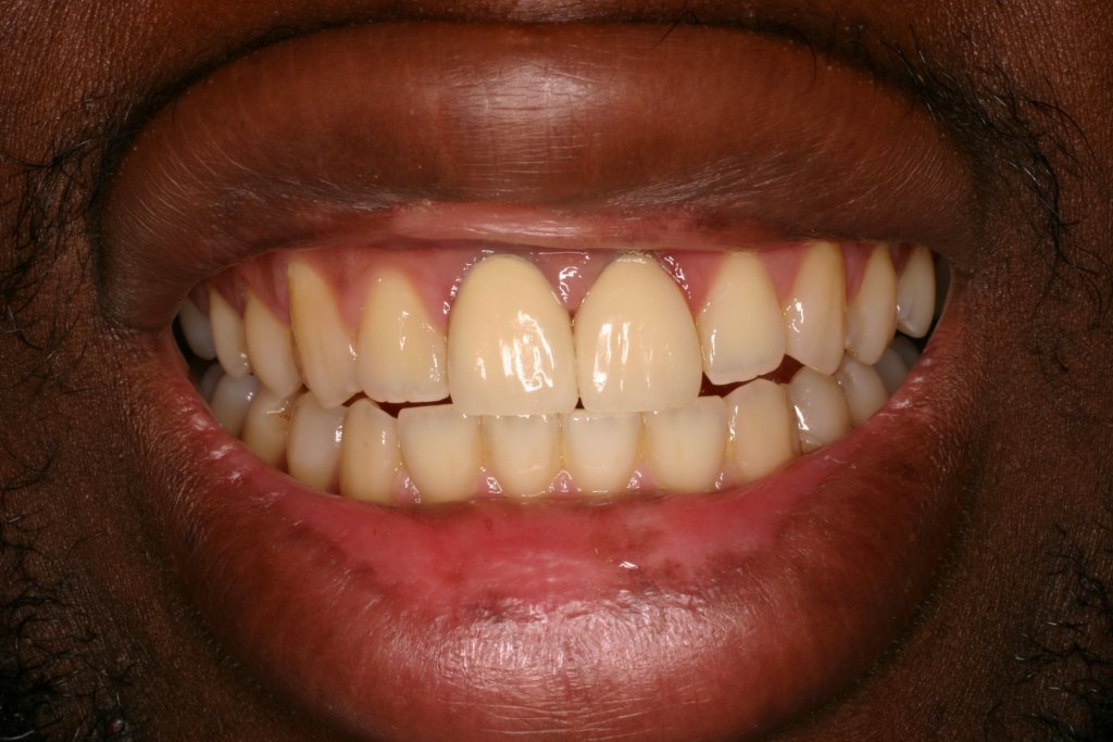 Up close photo of teeth