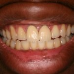Up close photo of teeth