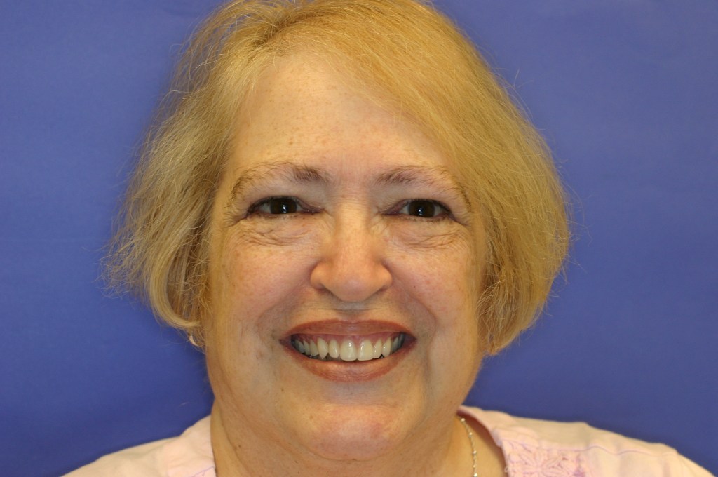 Photo of a smiling middle-aged woman