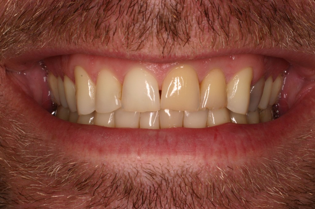 Up close photo of a smile