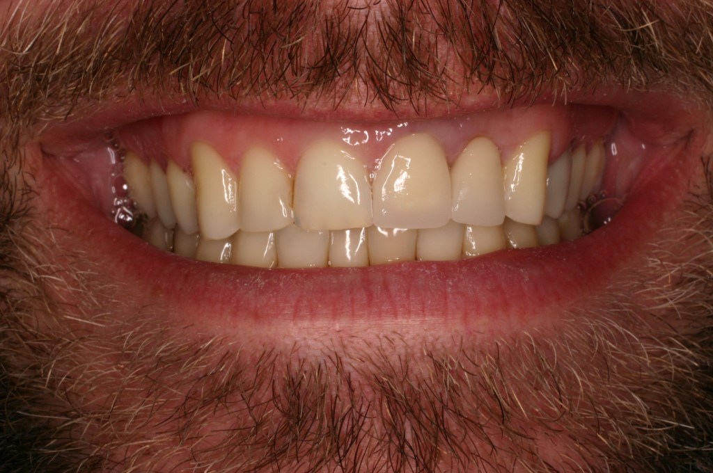 Up close photo of a smile