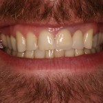 Up close photo of a smile