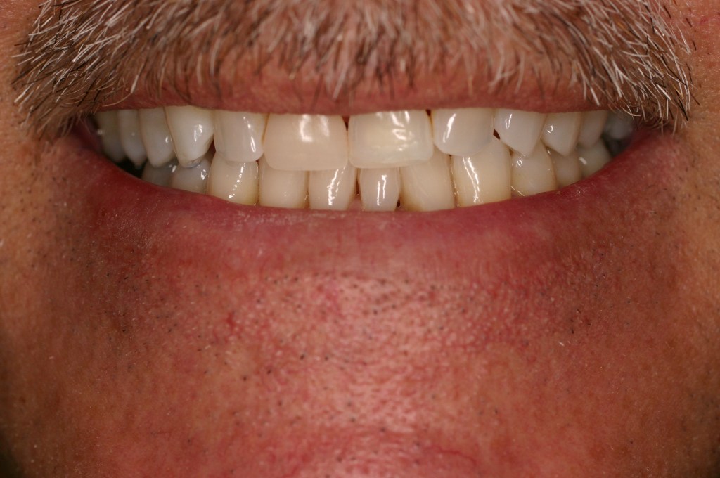 Up close photo of a smile
