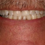 Up close photo of a smile
