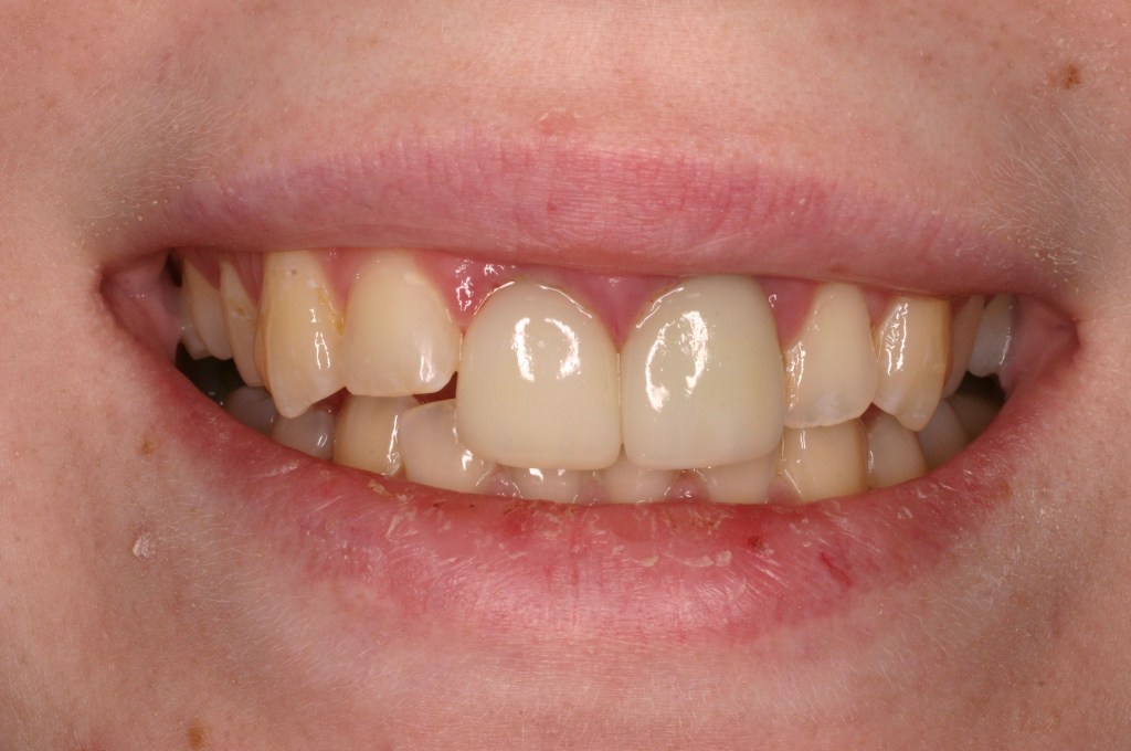 Up close photo of a smile