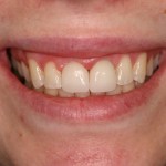 Up close photo of a smile