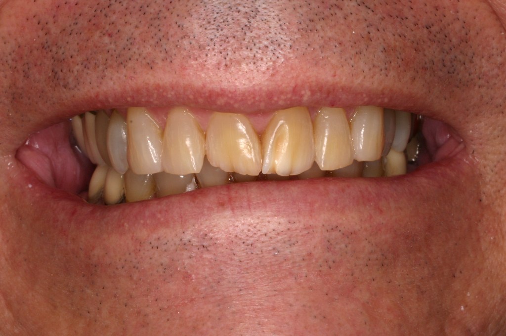 Up close photo of a smile