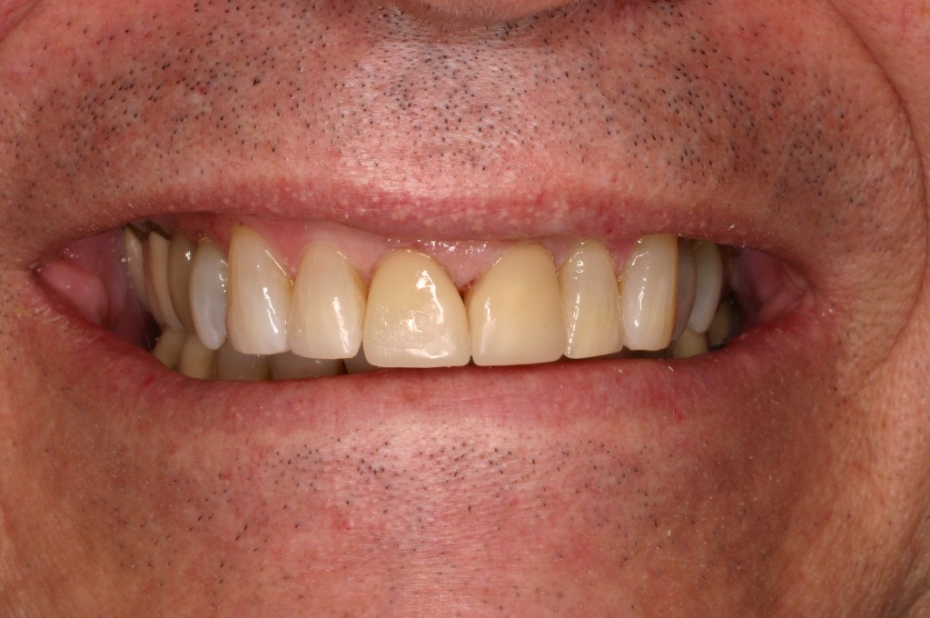 Up close photo of a smile