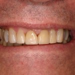 Up close photo of a smile