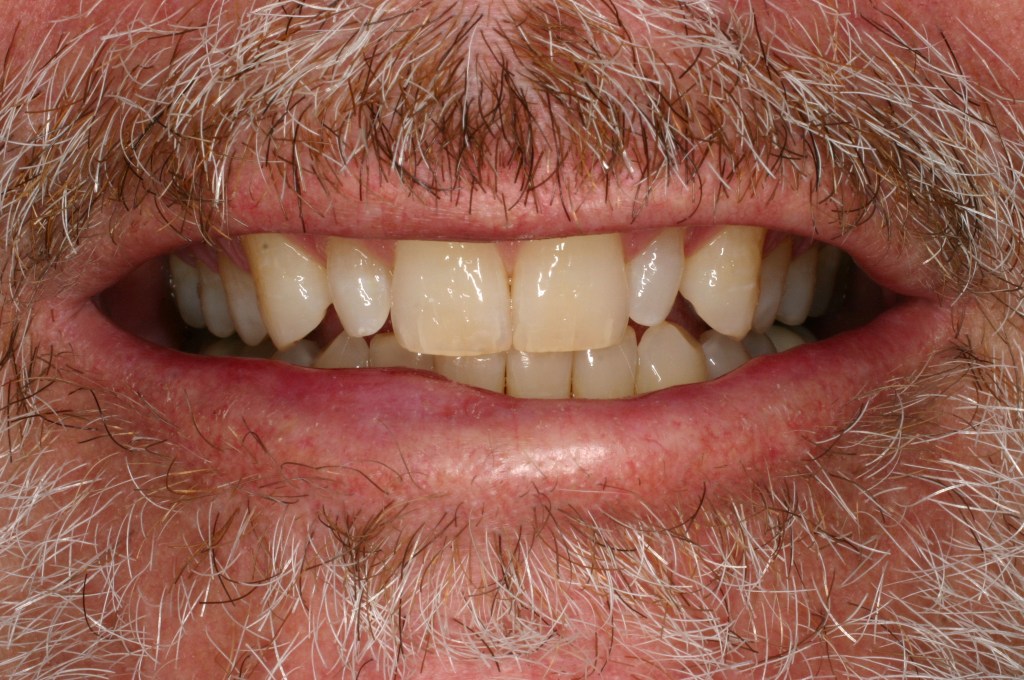 Up close photo of a smile