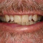 Up close photo of a smile