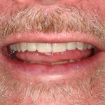 Up close photo of a smile